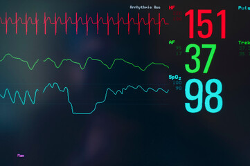Close-upÔøΩof EKG screen display