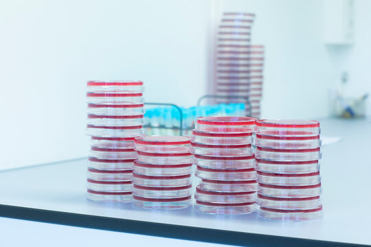 Petri dishes with growth medium in lab
