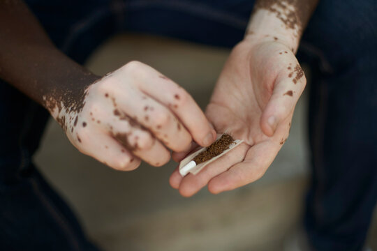 Close-up of young man with vitiligo rolling a cigarette