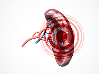 Anatomically accurate 3d illustration of human internal organ spleen with blood vessels artery and veins with disease isolated on white