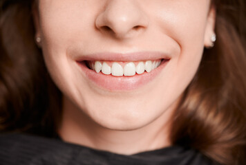 Fototapeta premium Close-up, cropped snapshot of beautiful healthy female smile. Front view. Macro photography. Oral hygiene concept