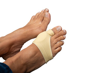 A middle age woman feet have bunion bent toe problem wearing foot support on treatment for bent toe problem and help to protect the toe from discomfort, pressure and inflammation caused by bunion.  - obrazy, fototapety, plakaty