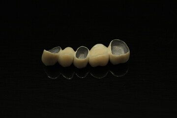 Fototapeta premium Long Zirconia bridge with all porcelain baked. PFM bridge. Dental technician 's works