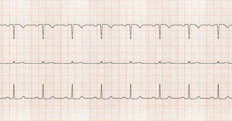 Cardiac physical graph paper seamless pattern. Electrocardiogram seamless texture