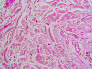 Histology microscope image of dense irregular connective tissue proper in dermis (400x)