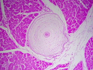 Histology microscope image of Pacinian corpuscle of the dermis in skin (100x)