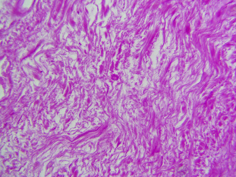 Histology microscope image of dense irregular connective tissue proper in dermis (400x)