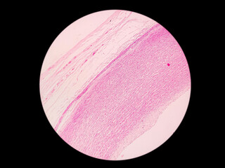 Histology of large sized artery : educational microscopic (LM) image