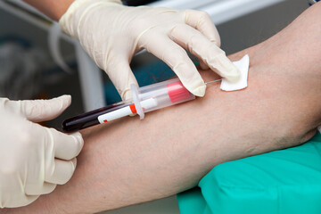 blood sampling procedure for analysis in a medical laboratory