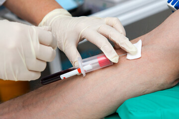 blood sampling procedure for analysis in a medical laboratory