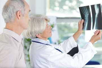 Obraz premium senior woman doctor showing patient x-rays