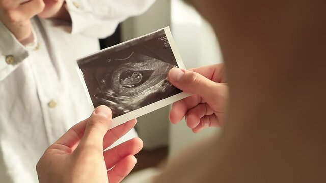 A white-skinned girl passes a guy an ultrasound picture