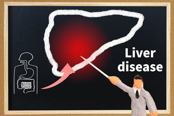Liver disease