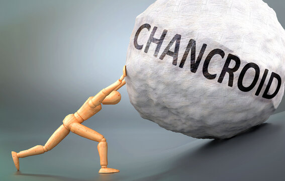 Chancroid - depiction, impression and presentation of this condition shown a wooden model pushing heavy weight to symbolize struggle and pain when dealing with Chancroid, 3d illustration