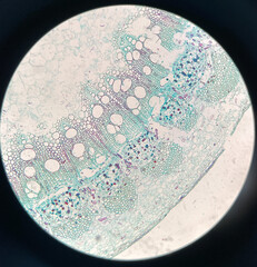 microscopic photo of pine stem structure