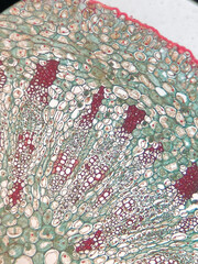 microscopic photo of viscum stem structure