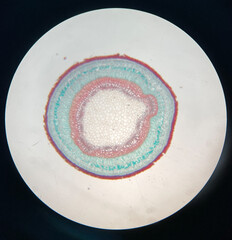 microscopic photo of Celastrus scandens stem