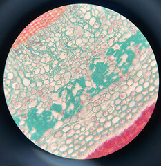 microscopic photo of Celastrus scandens stem