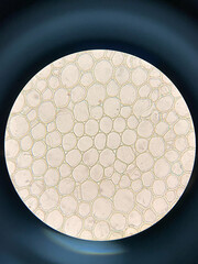 microscopic photo of orchid aerial root tissue