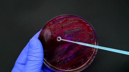 scientist pick-up Bacterial Colony with disposable loop cultured in a medium