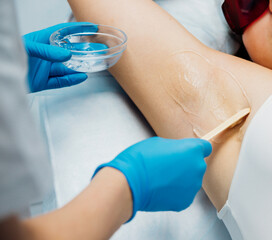 Fototapeta premium Applying a contact transparent gel before the laser hair removal procedure to the armpit area. Application of sugar paste for the sugaring procedure.