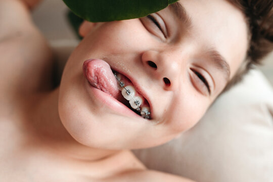 A young smiling boy with dental braces shows his tongue.