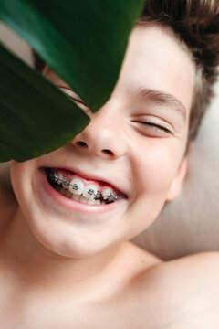A young laughing boy with dental brackets.
