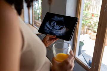 Digital ultrasound on a tablet