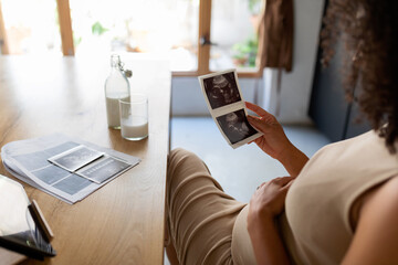 Prenatal woman looking ultrasound