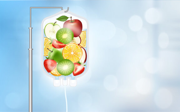 Different fruit slices inside saline bag orange, apple, strawberry and kiwi. IV Drip Vitamin infusion therapy, Healthy food and juice concepts. Realistic with 3D vector illustration.