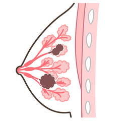乳がんのイラスト