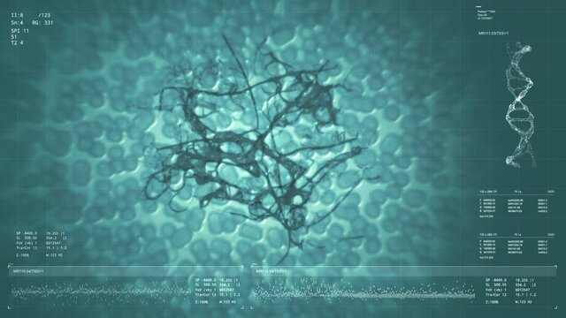 Cells in liqiuid under microscope. Virus infection, human cells expansion. Interstitial fluid, bacterial background. Medical research. Futuristic technology. HUD and data analysis. 3D Render 4K clip