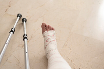 leg in bandage and crutches