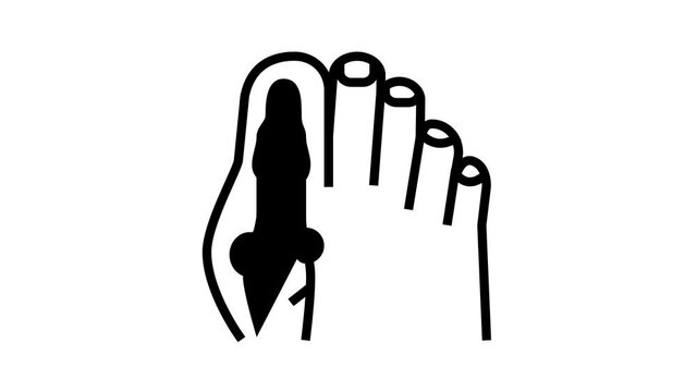 foot big toe bone gout animated line icon. foot big toe bone gout sign. isolated on white background