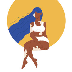 Girl with vitiligo skin. Beautiful girl. Love your body. Vector illustration.