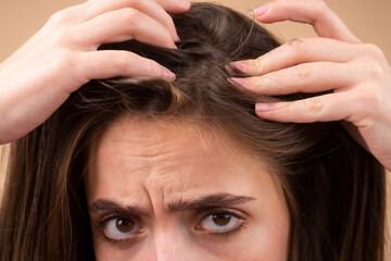 Naklejka premium Hair loss close up. Tangled problem hair macro.