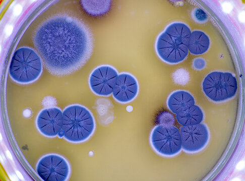 Fungal colonies on agar plate
