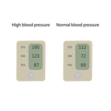 Normal and high blood pressure, illustration