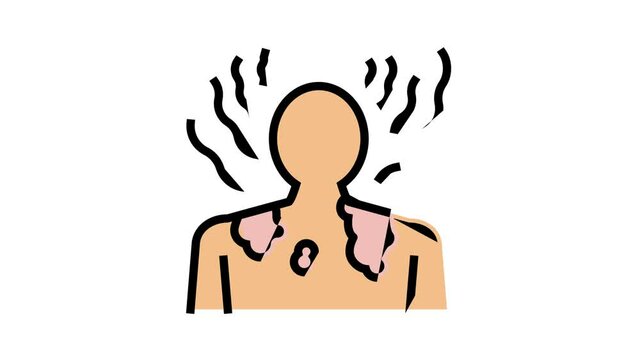 sunburn skin disease animated color icon. sunburn skin disease sign. isolated on white background