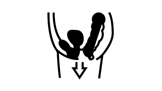 organ prolapse disease animated line icon. organ prolapse disease sign. isolated on white background