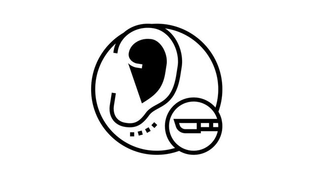 ear surgery animated line icon. ear surgery sign. isolated on white background