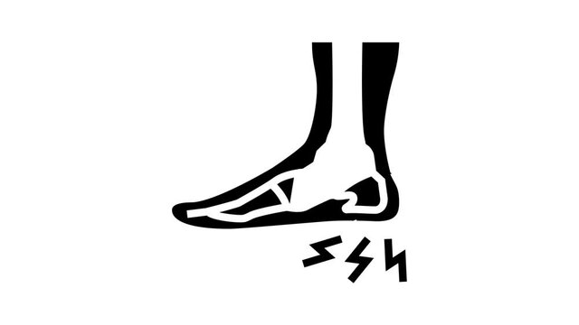 heel spur disease animated glyph icon. heel spur disease sign. isolated on white background