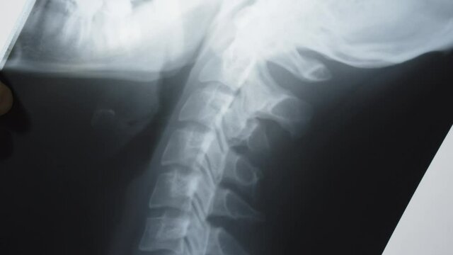 X-ray picture