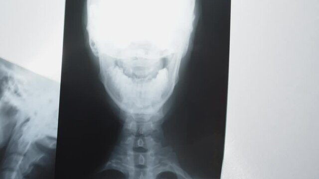 X-ray pictures