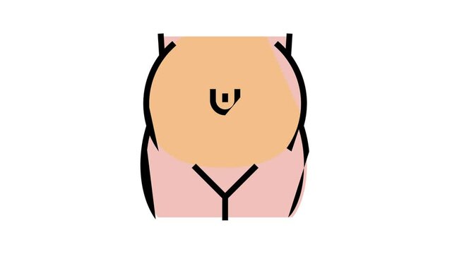 umbilical hernia disease animated color icon. umbilical hernia disease sign. isolated on white background