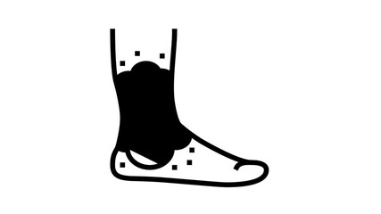 stasis dermatitis animated line icon. stasis dermatitis sign. isolated on white background