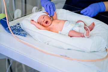 Unrecognizable nurse in blue gloves takes action and care for premature baby, selective focus on baby eye Newborn is placed in the incubator. Neonatal intensive care unit - obrazy, fototapety, plakaty