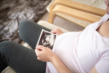 pregnant women holding ultra sound photo of her baby