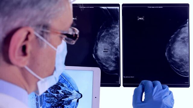 doctor examining breast x image