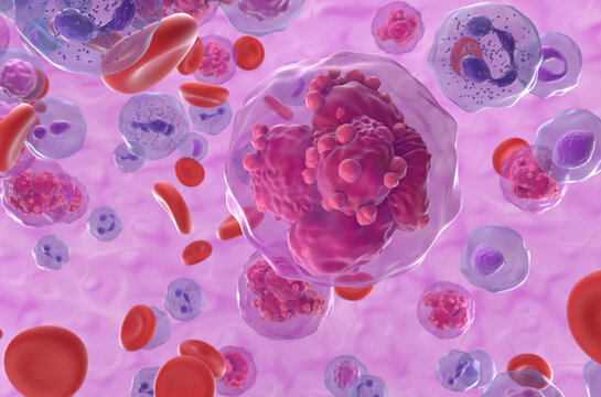 Acute lymphoblastic leukemia (ALL) cancer cells in the blood flow - closeup view 3d illustration